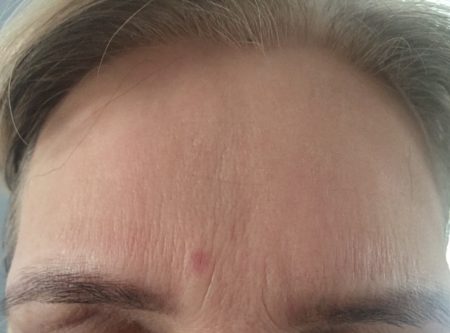 instantly ageless Nederland