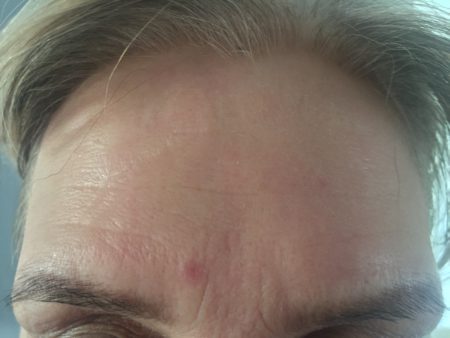 instantly ageless after